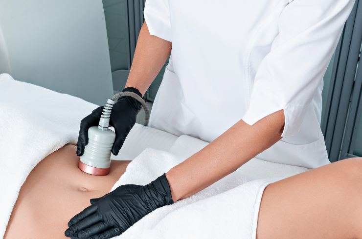 Body contouring procedures